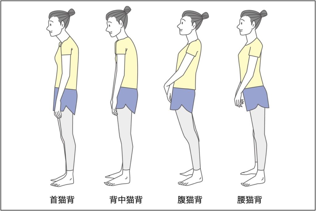 猫背はピラティスで改善する! その効果を解説♪ | FlexFit ピラティス・ワークアウト 綱島|綱島・日吉・大倉山|ヨガ・ジムとも違う!